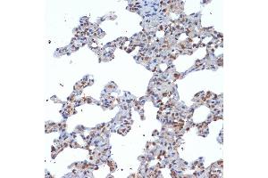 Immunohistochemistry of paraffin-embedded rat lung using SOCS2 Rabbit mAb (ABIN7270641) at dilution of 1:100 (40x lens).
