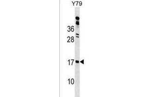 GR1 Antibody (N-term) 18154a western blot analysis in Y79 cell line lysates (35 μg/lane). (GLIPR2 抗体  (N-Term))