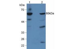 Western blot analysis of (1) Human Hepg2 Cells and (2) Mouse Liver Tissue. (GBA 抗体  (AA 334-498))