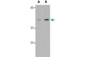 Western blot analysis of AGTR1 in mouse kidney tissue lysate with AGTR1 polyclonal antibody  at (A) 1 and (B) 2 ug/mL . (Angiotensin II Type-1 Receptor 抗体  (Internal Region))