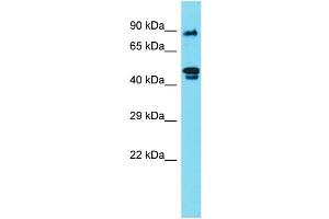 Host: Rabbit Target Name: RSPH4A Sample Type: 721_B Whole Cell lysates Antibody Dilution: 1. (RSPH4A 抗体  (N-Term))