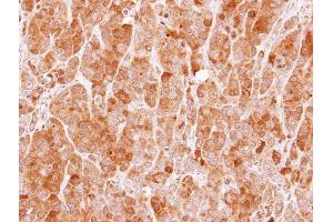 IHC-P Image Immunohistochemical analysis of paraffin-embedded MCF7 xenograft, using MVD, antibody at 1:100 dilution. (MVD 抗体  (Center))