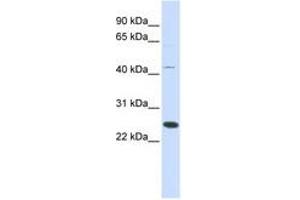 Image no. 1 for anti-Family With Sequence Similarity 119A (FAM119A) (AA 72-121) antibody (ABIN6741188) (FAM119A 抗体  (AA 72-121))