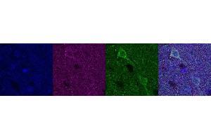 Immunohistochemistry (IHC) image for anti-Ubiquitin Carboxyl-terminal Esterase L1 (Ubiquitin Thiolesterase) (UCHL1) antibody (ABIN7456167) (UCHL1 抗体)