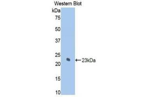 Western Blotting (WB) image for anti-Keratin 7 (KRT7) (AA 255-393) antibody (ABIN1859582) (Cytokeratin 7 抗体  (AA 255-393))