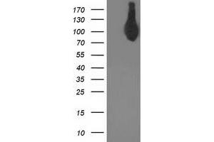 Western Blotting (WB) image for anti-Activating Signal Cointegrator 1 Complex Subunit 2 (ASCC2) antibody (ABIN1496740) (ASCC2 抗体)