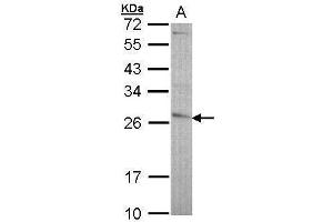 WB Image Sample (30 ug of whole cell lysate) A: A431 , 12% SDS PAGE antibody diluted at 1:5000 (GSTP1 抗体  (N-Term))