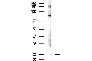 Western blot analysis of lysates from Mouse brain, using SCN1B Antibody at 1/1000 dilution.