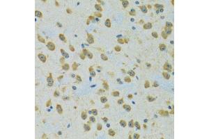 Immunohistochemistry of paraffin-embedded rat brain using RPS7 antibody. (RPS7 抗体  (AA 1-194))