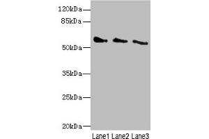 Western blot All lanes: CHRNG antibody at 5. (CHRNG 抗体  (AA 328-517))