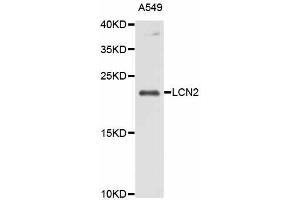 Western blot analysis of extracts of A-549 cells, using LCN2 antibody (ABIN5998120) at 1/1000 dilution. (Lipocalin 2 抗体)