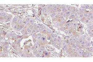 Immunohistochemistry (IHC) image for anti-Olfactory Receptor, Family 4, Subfamily D, Member 5 (OR4D5) antibody (ABIN6263864)
