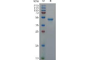 SDS-PAGE (SDS) image for Glial Cell Line Derived Neurotrophic Factor (GDNF) (AA 78-211) protein (Fc Tag) (ABIN6964190)