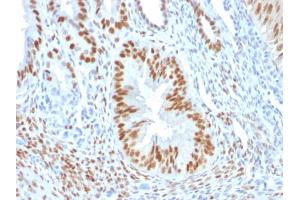 Immunohistochemistry (IHC) image for anti-Estrogen Receptor 1 (ESR1) (AA 2-185) antibody (ABIN6939348)