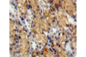 IHC-P analysis of kidney tissue, with DAB staining. (SLIT3 抗体  (AA 454-498))