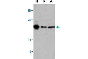 Western blot analysis of NOL3 in HeLa (H), KB (K), and A-549 (A) whole cell lysates with NOL3 polyclonal antibody  at 1 : 1000 dilution. (NOL3 抗体  (AA 191-208))