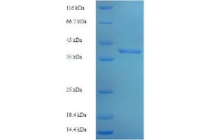 SDS-PAGE (SDS) image for CINP (CINP) (AA 1-212), (full length) protein (His-SUMO Tag) (ABIN5711753)