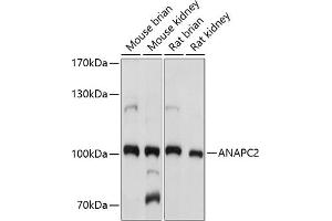 Western blot analysis of extracts of various cell lines, using  antibody (ABIN7265581) at 1:1000 dilution. (ANAPC2 抗体  (AA 400-500))