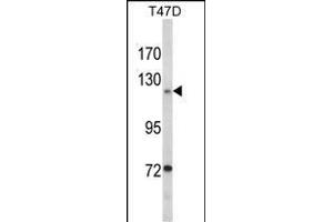 Western blot analysis of PTK2 Antibody (Center) (ABIN1882121 and ABIN2842373) in T47D cell line lysates (35 μg/lane). (FAK 抗体  (AA 396-423))