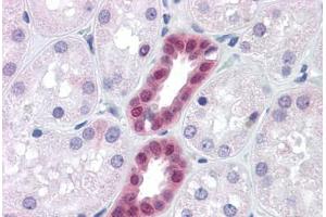 Human Kidney: Formalin-Fixed, Paraffin-Embedded (FFPE) (PAX2A 抗体  (AA 194-304))
