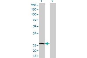 Western Blot analysis of PSPH expression in transfected 293T cell line by PSPH monoclonal antibody (M01A), clone 3A5. (PSPH 抗体  (AA 1-225))