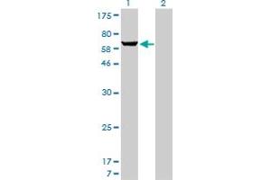 Western Blot analysis of PAPSS1 expression in transfected 293T cell line by PAPSS1 monoclonal antibody (M05), clone 1F4. (PAPSS1 抗体  (AA 144-252))