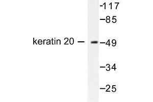 Image no. 1 for anti-Keratin 20 (KRT20) antibody (ABIN265500) (KRT20 抗体)