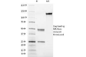 SDS-PAGE Analysis Purified CD41a Mouse Monoclonal Antibody (ITGA2B/1036). (Integrin Alpha2b 抗体)
