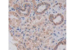 Used in DAB staining on fromalin fixed paraffin- embedded kidney tissue (PEX1 抗体  (AA 62-219))
