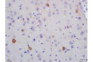 Formalin-fixed and paraffin embedded rat brain labeled with Anti-NF-H Polyclonal Antibody, Unconjugated  at 1:200 followed by conjugation to the secondary antibody and DAB staining (NEFH 抗体  (AA 21-120))