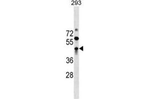 ZBTB32 Antibody (N-term) western blot analysis in 293 cell line lysates (35 µg/lane). (ZBTB32 抗体  (N-Term))