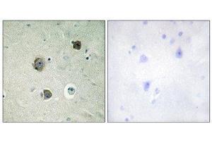 Immunohistochemistry (IHC) image for anti-Cyclin-Dependent Kinase 5 (CDK5) (Tyr15) antibody (ABIN1848070) (CDK5 抗体  (Tyr15))