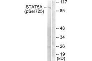 Western blot analysis of extracts from Jurkat cells treated with EGF 200ng/ml 30', using STAT5A/B (Phospho-Ser725/730) Antibody. (STAT5 A/B 抗体  (pSer726))
