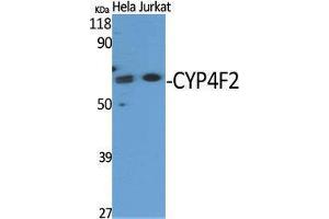 Western Blotting (WB) image for anti-Cytochrome P450, Family 4, Subfamily F, Polypeptide 2 (CYP4F2) (N-Term) antibody (ABIN3184201) (CYP4F2 抗体  (N-Term))