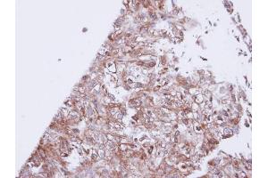 IHC-P Image Immunohistochemical analysis of paraffin-embedded DU145 xenograft, using GIRK1, antibody at 1:100 dilution. (KCNJ3 抗体  (Center))
