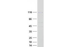 Western Blotting (WB) image for Polymerase (DNA Directed) kappa (POLK) protein (Myc-DYKDDDDK Tag) (ABIN2719558)