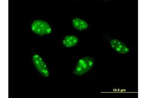 Immunofluorescence of purified MaxPab antibody to TSPYL1 on HeLa cell. (TSPYL1 抗体  (AA 1-438))