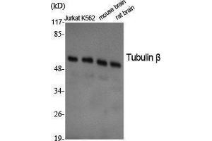 Western Blotting (WB) image for anti-Tubulin, beta (TUBB) (C-Term) antibody (ABIN3187378) (TUBB 抗体  (C-Term))