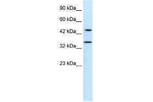 WB Suggested Anti-PNMA1 Antibody Titration:  0. (PNMA1 抗体  (Middle Region))