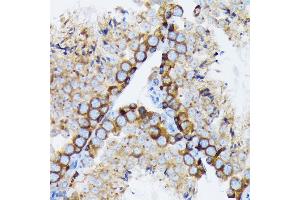 Immunohistochemistry (IHC) image for anti-Tubulin, gamma 1 (TUBG1) antibody (ABIN7271052)