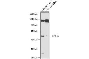 Western blot analysis of extracts of various cell lines, using RNF13 antibody (ABIN6128641, ABIN6147009, ABIN6147010 and ABIN6224394) at 1:1000 dilution. (RNF13 抗体  (AA 204-381))