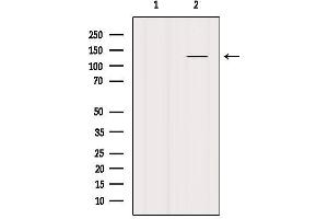 Western blot analysis of extracts from Mouse lung, using SMC3 Antibody. (SMC3 抗体  (C-Term))