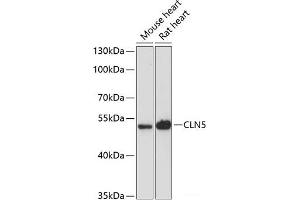 Western blot analysis of extracts of various cell lines using CLN5 Polyclonal Antibody at dilution of 1:3000. (CLN5 抗体)