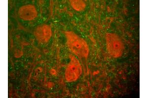 Rat spinal cord stained with anti-UCHL1(red) and anti-neurofilament NF-H antibody (1451-NFH)(green). (UCHL1 抗体)