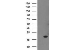 Western Blotting (WB) image for anti-Retinol Binding Protein 1, Cellular (RBP1) antibody (ABIN1497626)