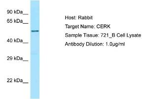 Host: Rabbit Target Name: CERK Sample Type: 721_B Whole Cell lysates Antibody Dilution: 1. (CERK 抗体  (C-Term))