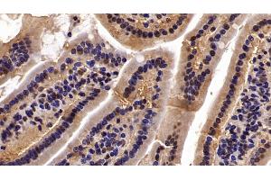 Immunohistochemistry (IHC) image for anti-Chromobox Homolog 3 (CBX3) (AA 1-183) antibody (ABIN7434851)