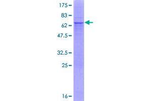 Image no. 1 for Carbonic Anhydrase 12 (CA12) (AA 1-354) protein (GST tag) (ABIN1347759)
