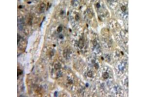 Used in DAB staining on fromalin fixed paraffin-embedded Liver tissue (MYB 抗体  (AA 305-558))