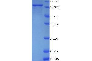 SDS-PAGE (SDS) image for Peptidyl Arginine Deiminase, Type II (PADI2) (AA 1-665), (full length) protein (His tag) (ABIN5714528)